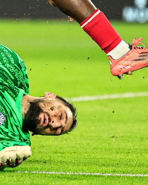 德媒：由于手指受伤，诺伊尔近两场都佩戴特制的四指手套参赛